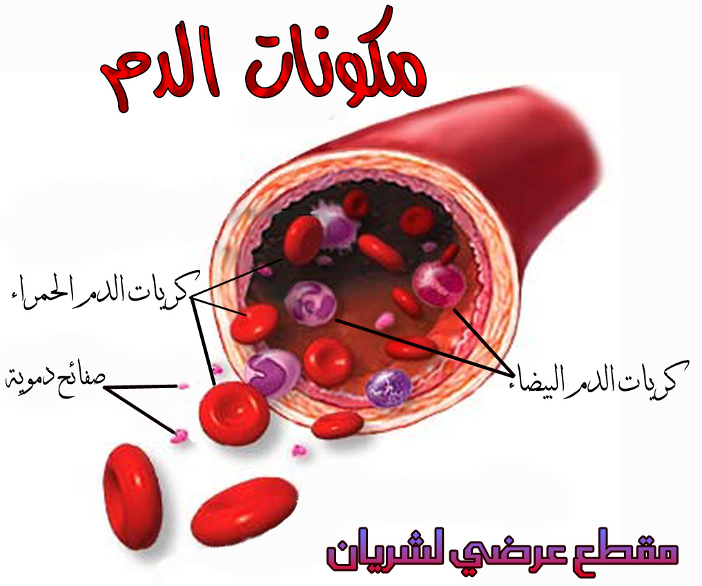 ما هو تعريف فقر الدم الخبيث؟ e3arabi