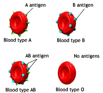  Anemia 71888.jpg